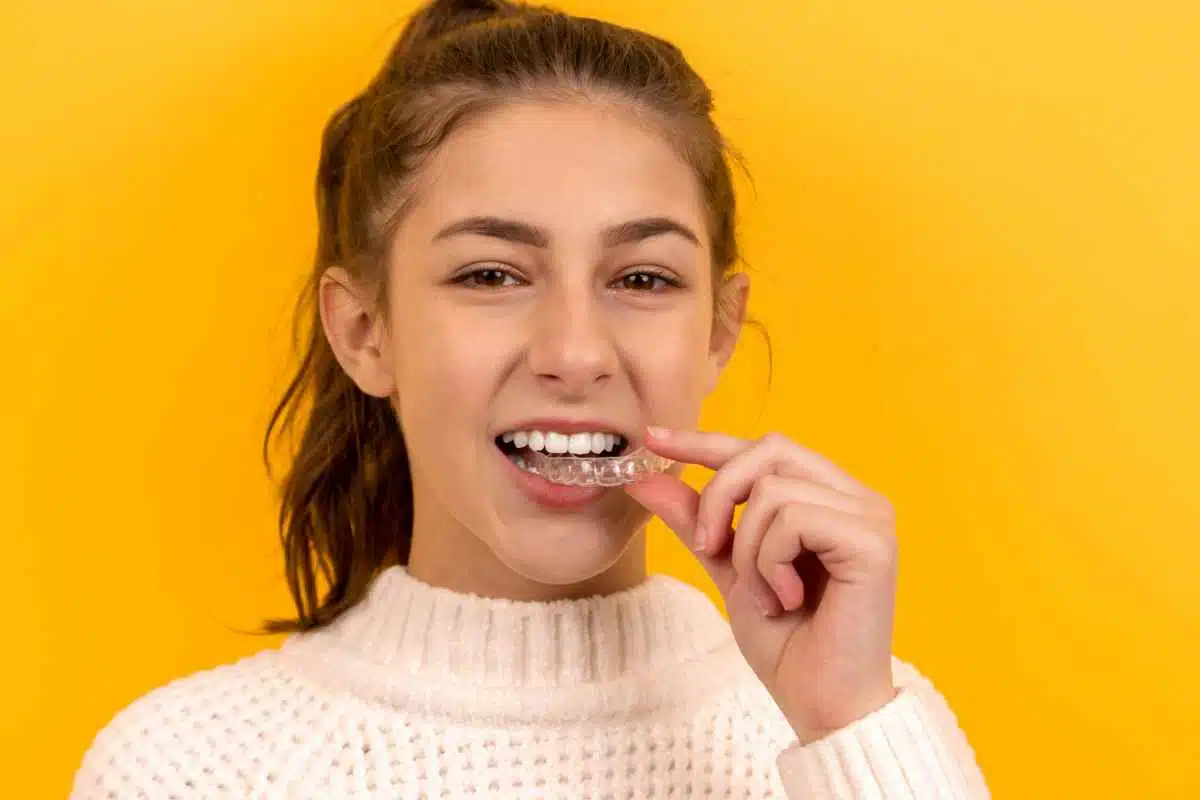 Costo apparecchio denti: cosa sapere prima di iniziare un trattamento ortodontico 1